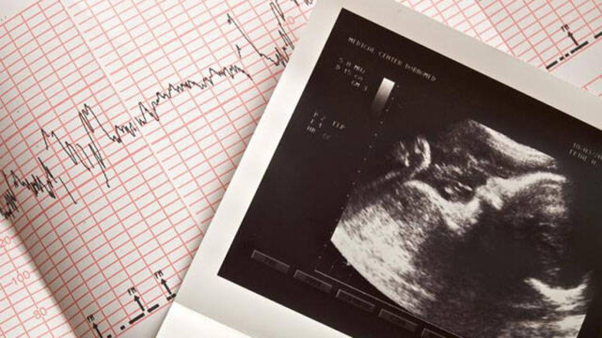 Cardiograma con información de los latidos del corazón de un bebé
