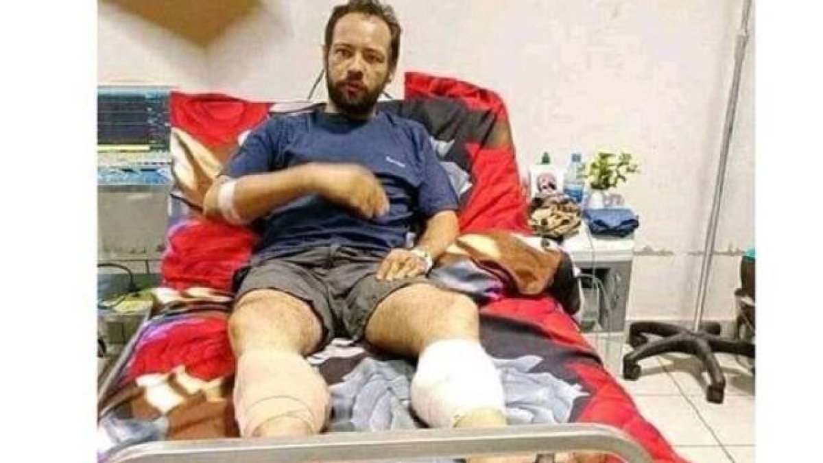 Christian Carlassare, en el hospital tras haber sido curado de las heridas de bala