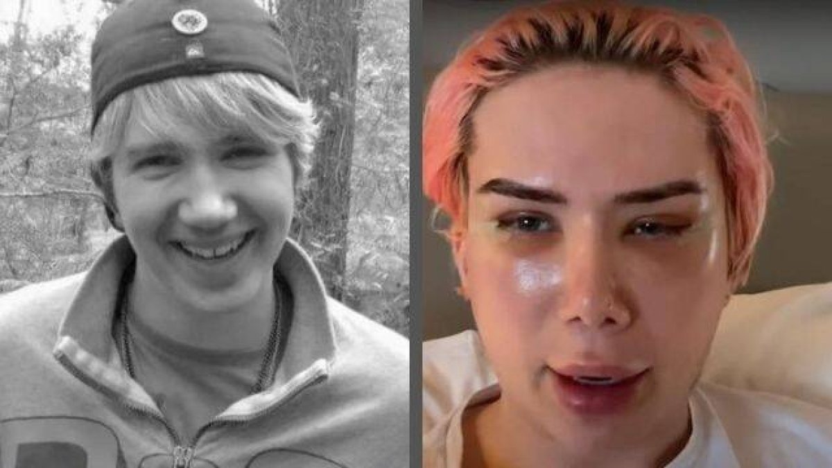 El influencer británico Oli London, que ha reconocido haber sido infeliz durante años, se declara coreano tras 18 cirugías que le han costado 150.000 dólares.