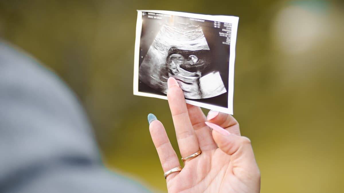 Desde el momento de la concepción, la madre lleva dentro de sí un ser humano que a todos nos hace falta. Foto (contextual): Dave Goudreau / Unsplash.