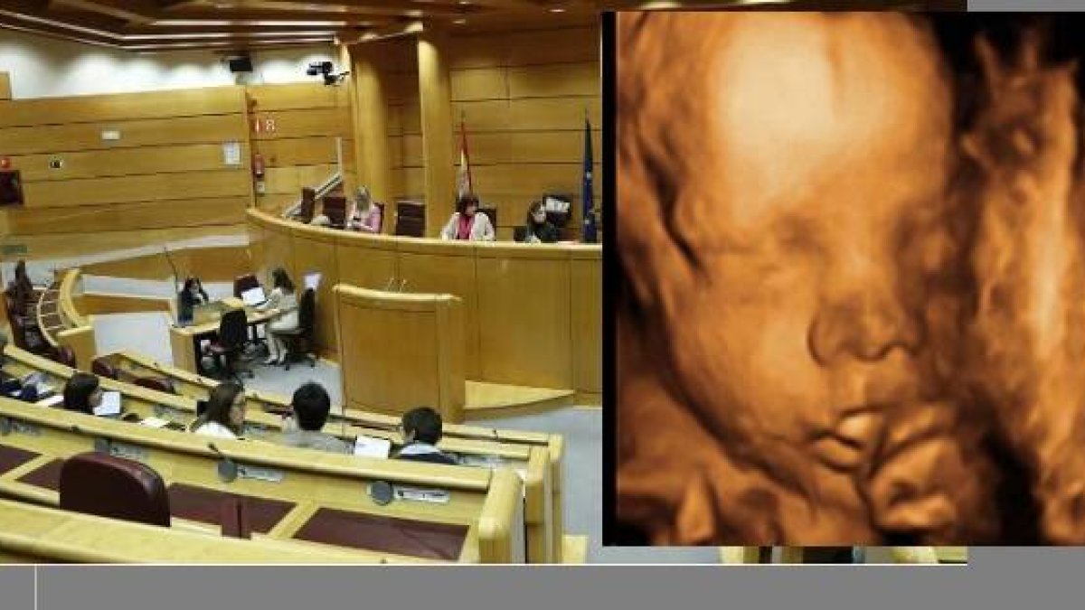 El Senado español endurece la Ley del Aborto para que no se informe casi nada a la embarazada sobre riesgos o alternativas