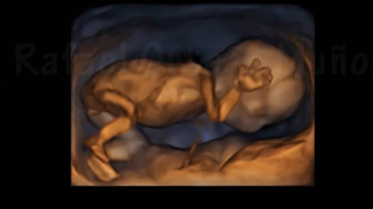 Ecografía 4D de un feto de 14 semanas. Imagen: captura vídeo Youtube canal Rafael Ortega Muñoz, ginecólogo.