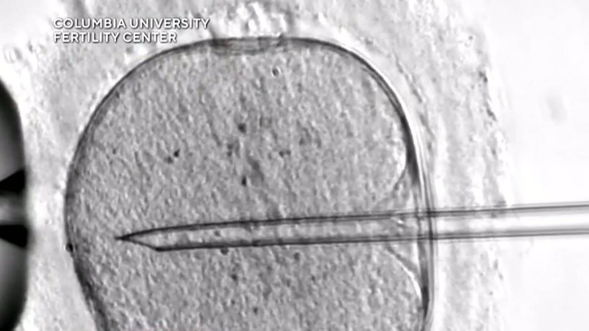 Un proceso de fecundación in vitro. Foto: Captura CBS.